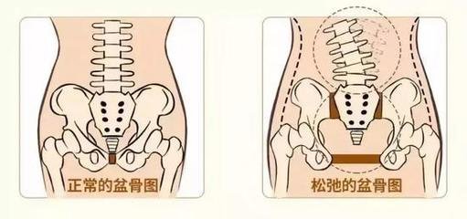 妇产骨盆平面设计方案