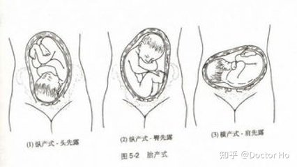妇产骨盆平面设计方案