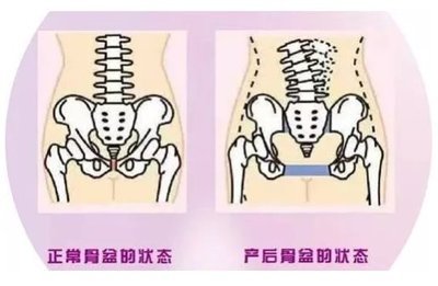 妇产骨盆平面设计方案