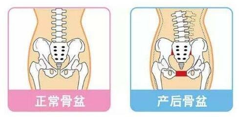 妇产骨盆平面设计方案